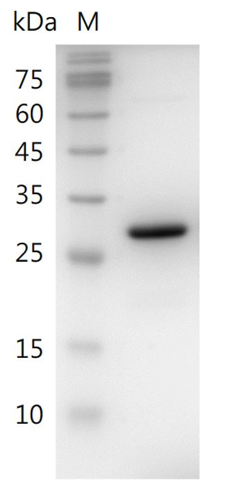Human HMGB1 Protein, His tag (Animal-Free)