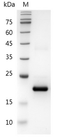 Human IFN-à1a Protein, His tag (Animal-Free)