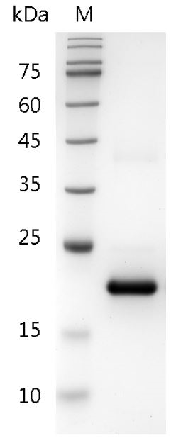 Human IFN-à1a Protein, His tag (Animal-Free)