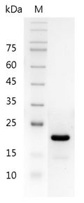 Human IL-11 Protein, His tag (Animal-Free)