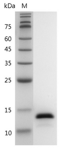 Human IL-2 Protein, His tag (Animal-Free)