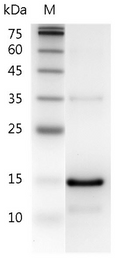 Human IL-21 Protein, His tag (Animal-Free)