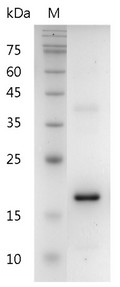 Human IL-37 Protein, His tag (Animal-Free)