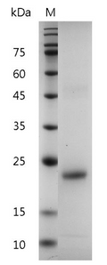 Human IL-6 Protein, His tag (Animal-Free)