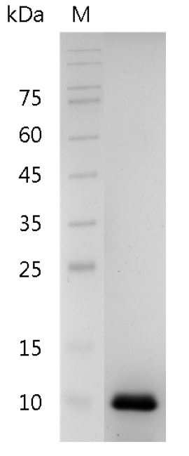Human IL-8 (72 a.a.) Protein, His tag (Animal-Free)