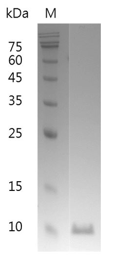 Human MIF Protein, His tag (Animal-Free)