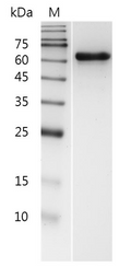 Human MMP2 (active) Protein, His tag (Animal-Free)
