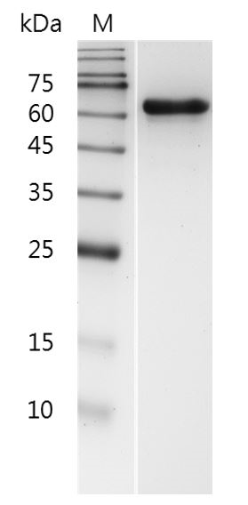 Human MMP2 (active) Protein, His tag (Animal-Free)