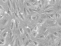 HUVEC, single donor cell
