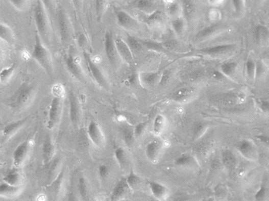 HUVEC, single donor cell