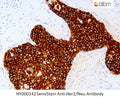 SensiStain™ Anti-Her2/Neu Antibody – Figure 1 of 1
