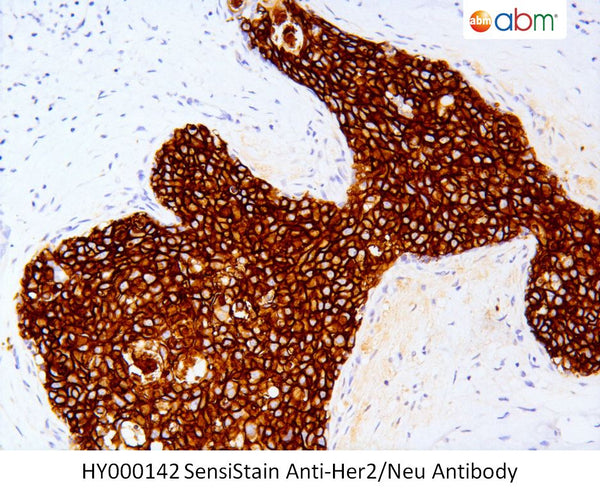 SensiStain™ Anti-Her2/Neu Antibody – Figure 1 of 1
