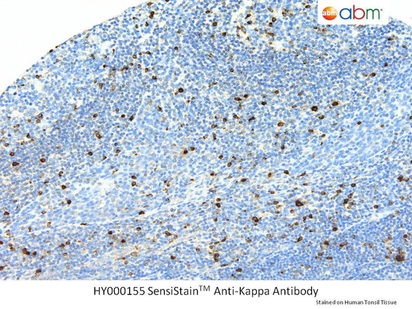 SensiStain™ Anti-Kappa Antibody – Figure 1 of 1