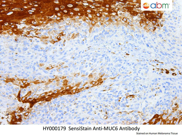 SensiStain™ Anti-MUC6 Antibody – Figure 1 of 1