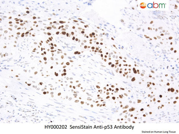 SensiStain™ Anti-p53 Antibody – Figure 1 of 1