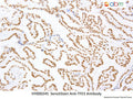 SensiStain™ Anti-TFE3 Antibody – Figure 1 of 1