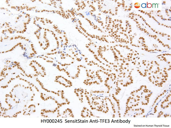 SensiStain™ Anti-TFE3 Antibody – Figure 1 of 1