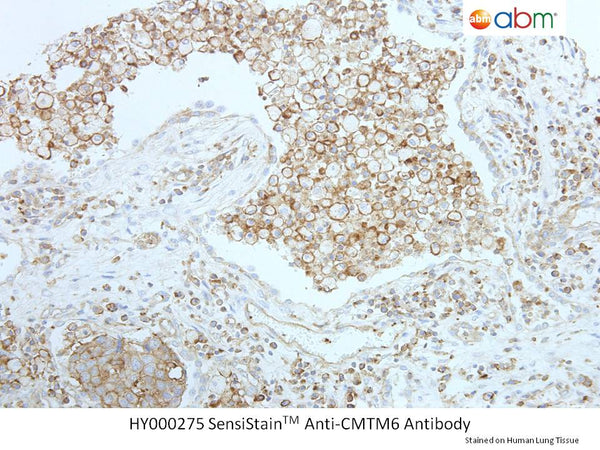 SensiStain™ Anti-CMTM6 Antibody – Figure 1 of 1