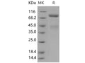 Recombinant Human c-MET/HGFR Protein (His Tag) – Figure 1 of 2