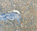 BCAT1 Polyclonal Antibody – Figure 1 of 3