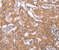 FBXO31 Polyclonal Antibody – Figure 1 of 3