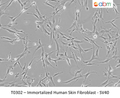 Immortalized Human Skin Fibroblast - SV40 | Applied Biological Materials (abm)