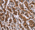 ID2 Polyclonal Antibody – Figure 1 of 3