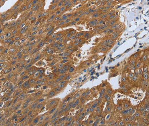 DLG4 Polyclonal Antibody – Figure 1 of 2