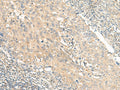 CHP1 Polyclonal Antibody – Figure 1 of 3