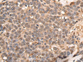ATRIP Polyclonal Antibody – Figure 1 of 3