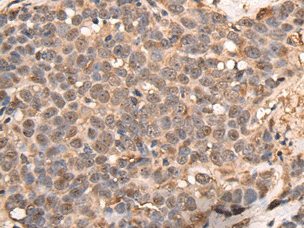 ATRIP Polyclonal Antibody – Figure 1 of 3