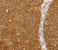 ABCC8 Polyclonal Antibody – Figure 1 of 3