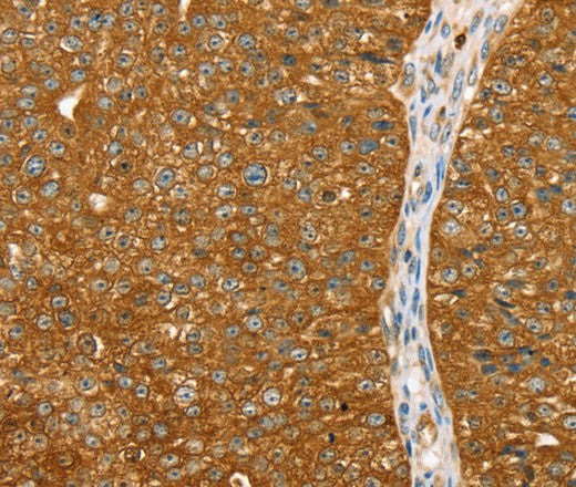 ABCC8 Polyclonal Antibody – Figure 1 of 3