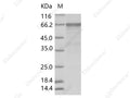 Recombinant Enterovirus D68 (EV-D68) (strain Fermon) VP1 Protein (Fc Tag) - Figure 1 of 2