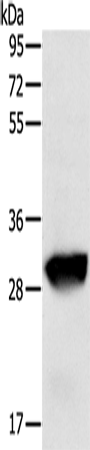 GSTO1 Polyclonal Antibody – Figure 1 of 4