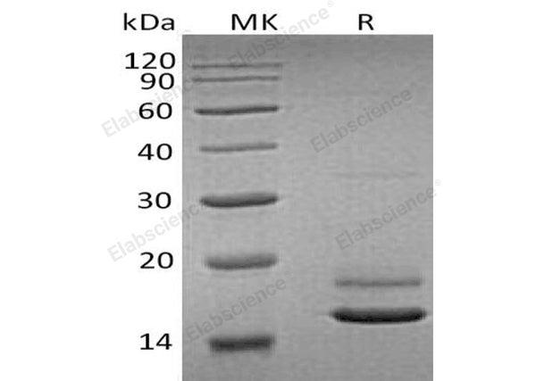 Recombinant Human ERMAP Protein (His Tag) – Figure 1 of 2