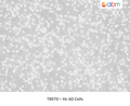 HL-60 Cells – Figure 1 of 1