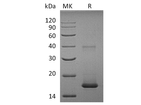 Recombinant Human IL1F10/IL-38 Protein – Figure 1 of 2