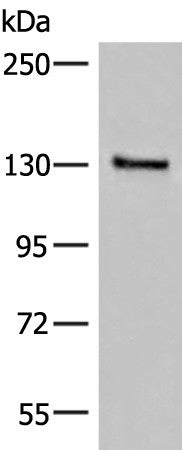 SASH1 Polyclonal Antibody – Figure 1 of 3