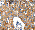 GluR2 Polyclonal Antibody – Figure 1 of 3