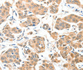 ADCK1 Polyclonal Antibody – Figure 1 of 3