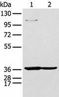 NUDT19 Polyclonal Antibody – Figure 1 of 3