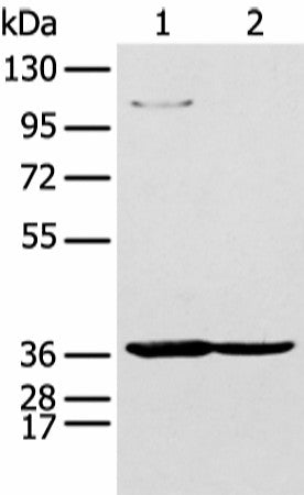 NUDT19 Polyclonal Antibody – Figure 1 of 3