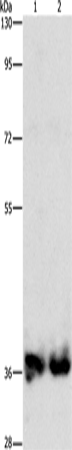 ASPA Polyclonal Antibody – Figure 1 of 4