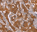 DCTN6 Polyclonal Antibody – Figure 1 of 3