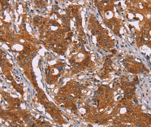 DCTN6 Polyclonal Antibody – Figure 1 of 3