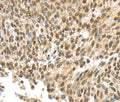 APOL6 Polyclonal Antibody – Figure 1 of 3