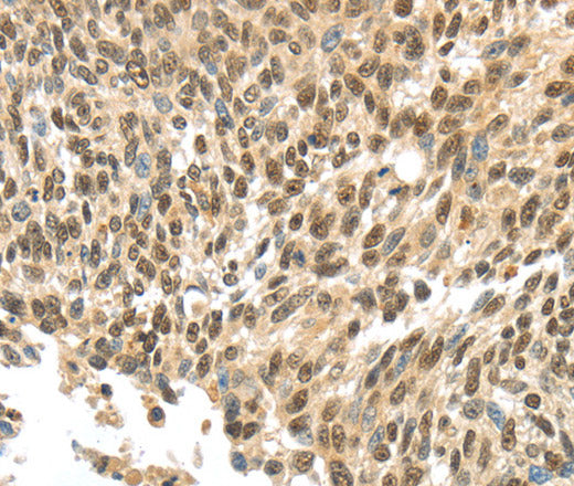 APOL6 Polyclonal Antibody – Figure 1 of 3