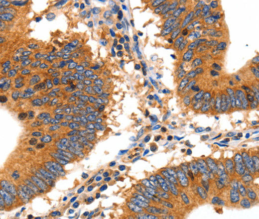 SLC2A2 Polyclonal Antibody – Figure 1 of 3