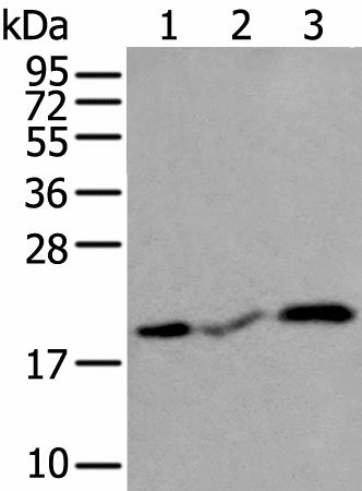CSRP3 Polyclonal Antibody – Figure 1 of 4
